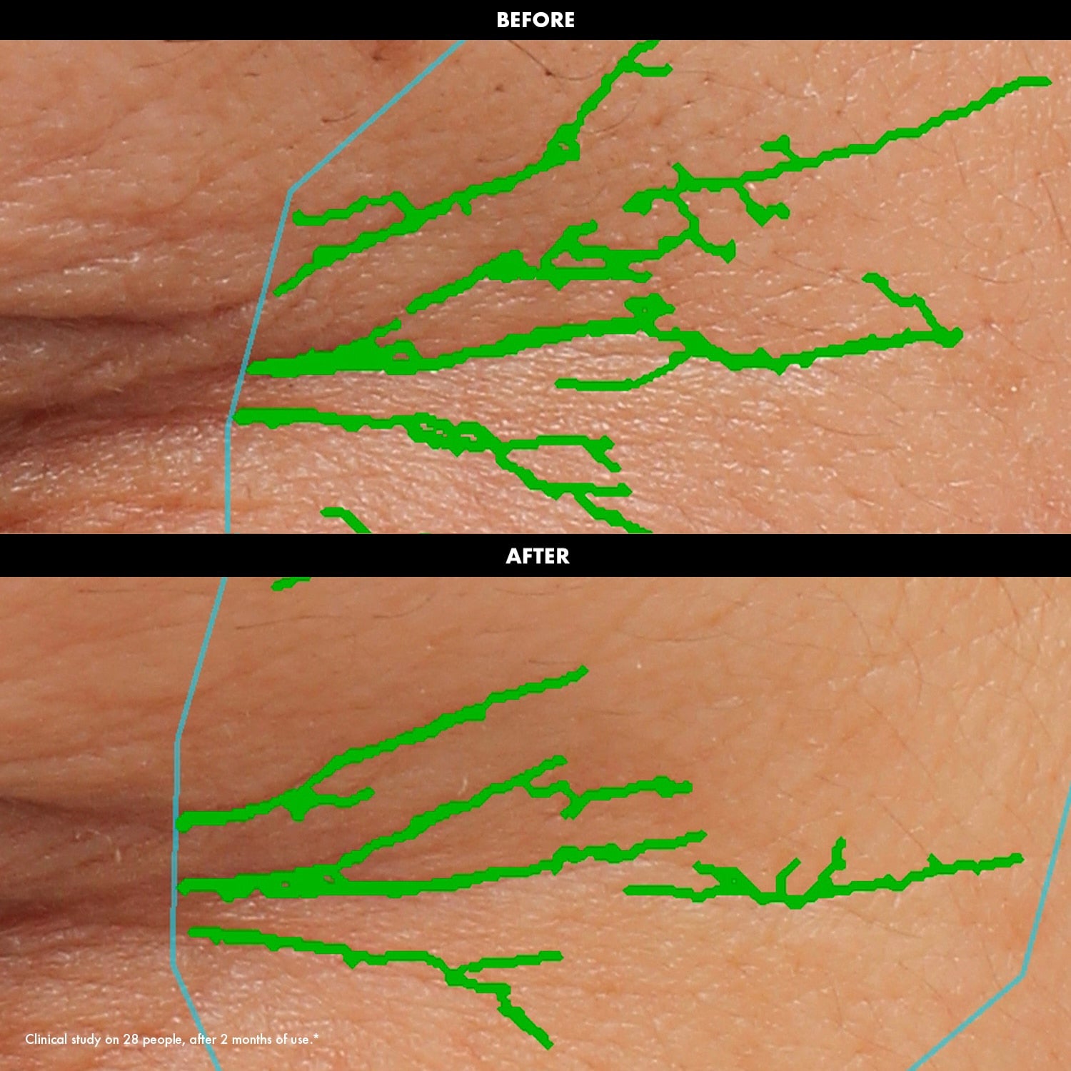 Lift & Firm - Crema de Ojos Alisadora Y Reafirmante