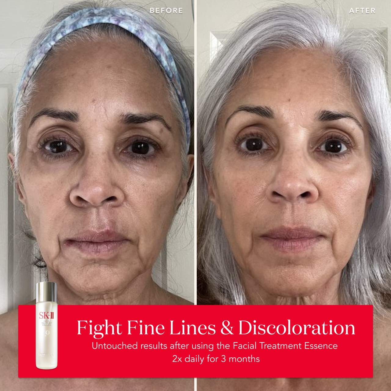 Esencia de tratamiento facial para pieles envejecidas con antioxidantes