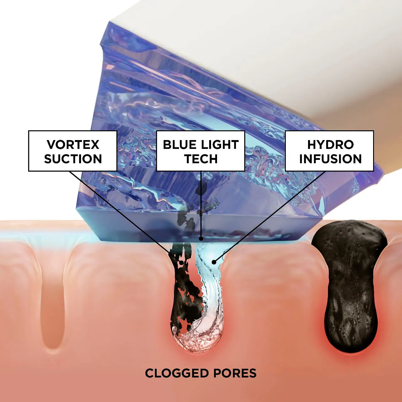Limpiador de poros GLOfacial Hydro-Infusion + Herramienta clarificadora con LED azul