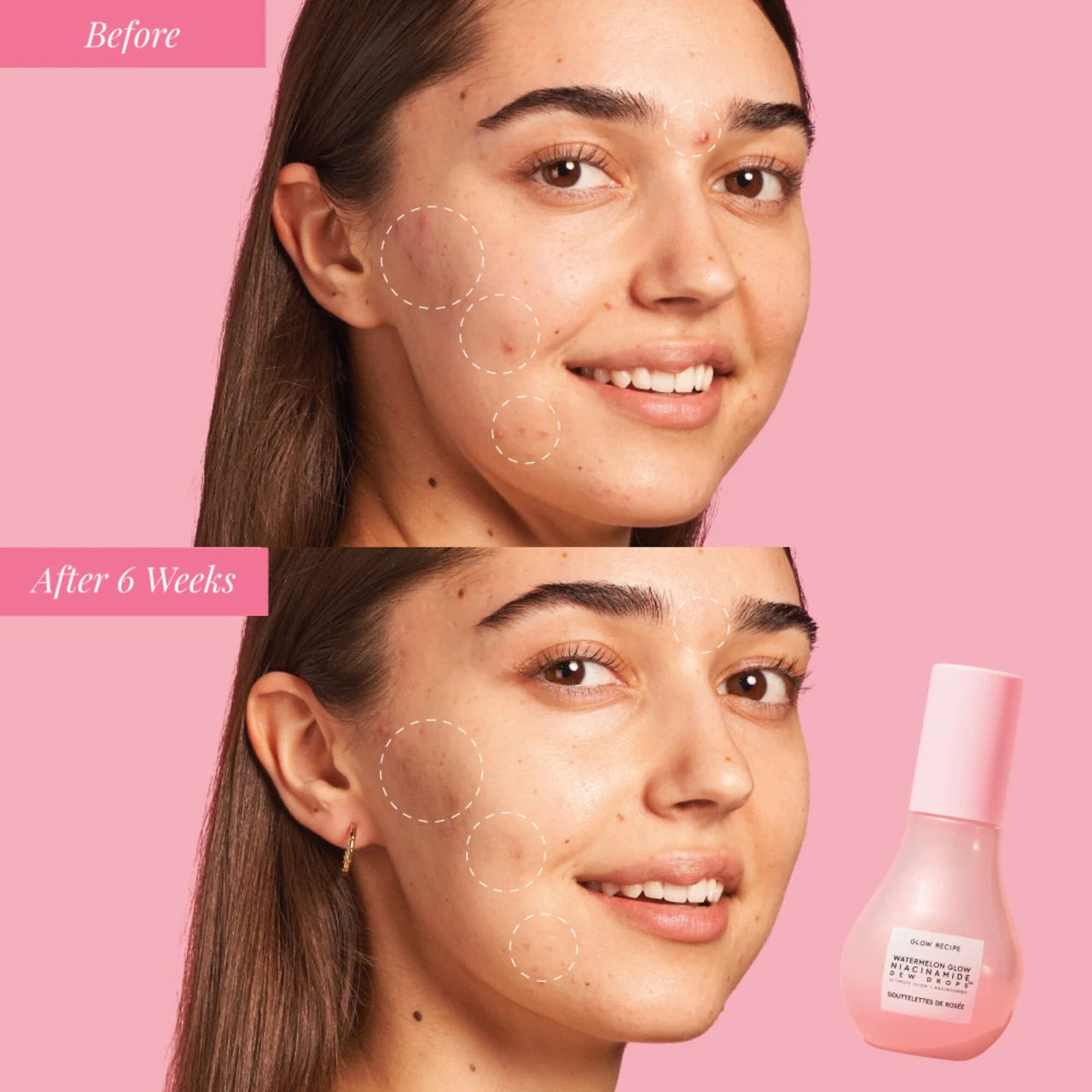 Suero Watermelon Glow Niacinamide Dew Drops