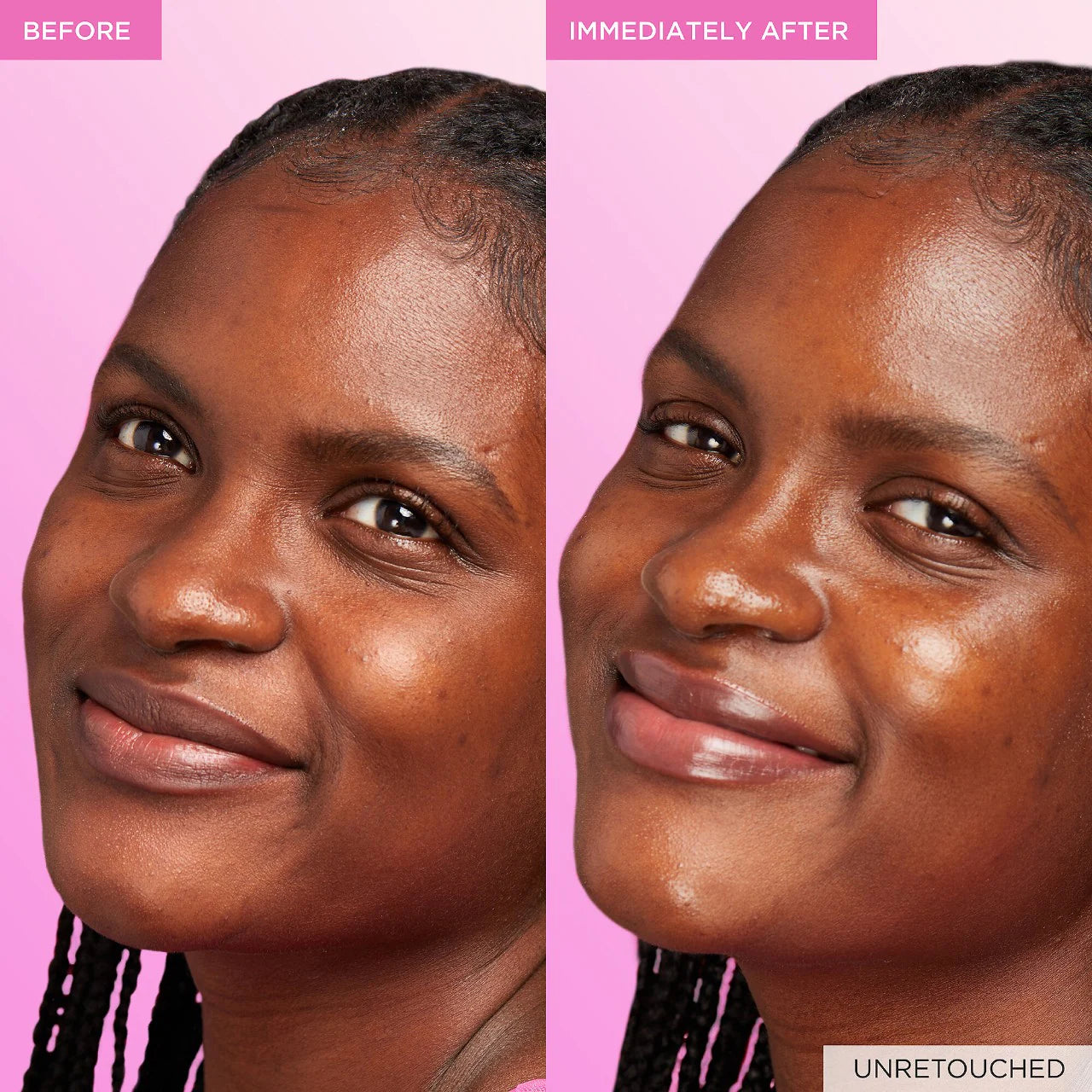 Suero Watermelon Glow Niacinamide Dew Drops