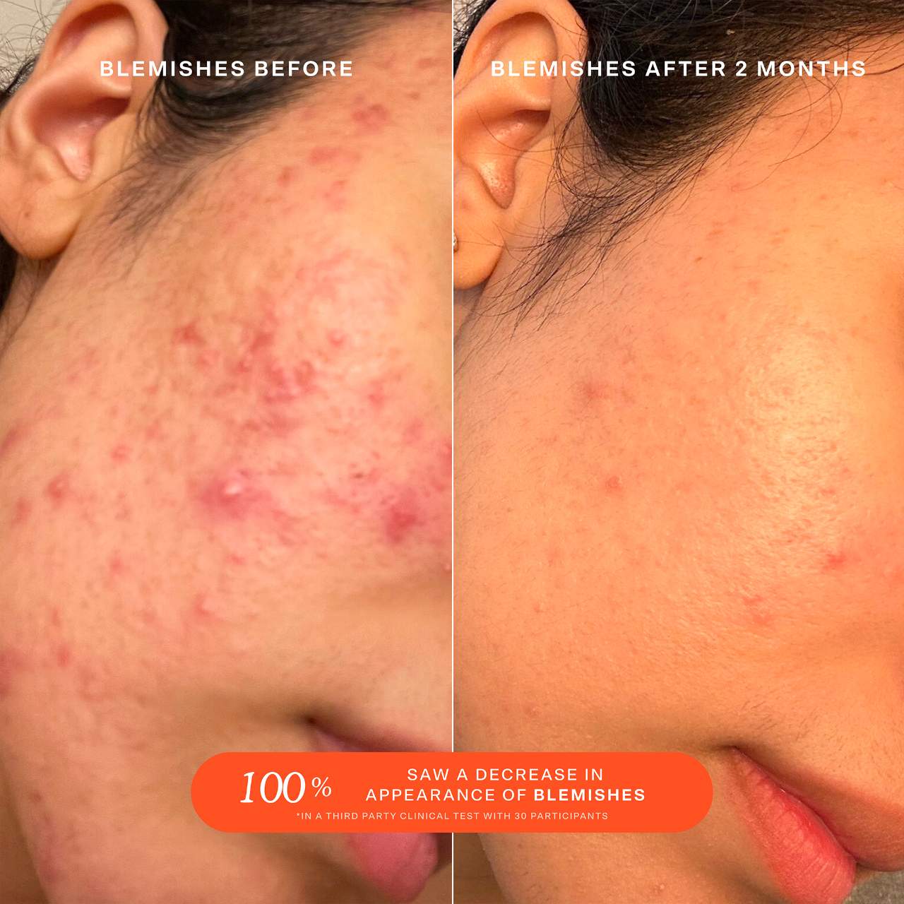 Spray facial SOS Daily Rescue con ácido hipocloroso