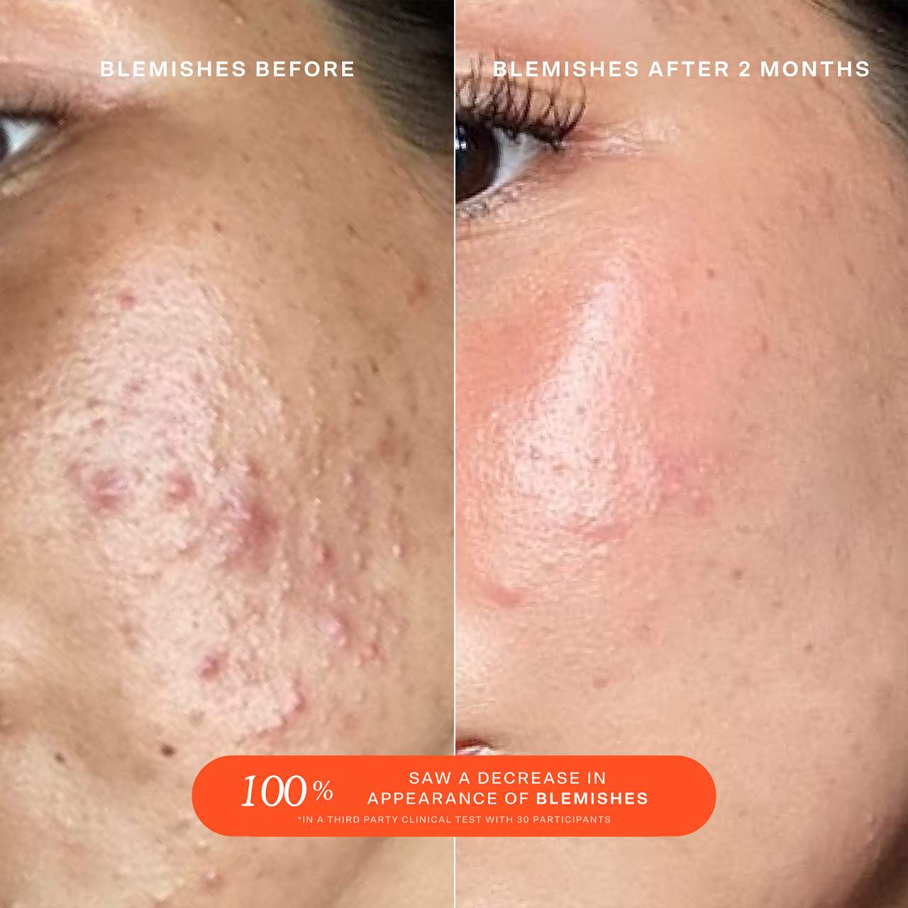 Spray facial SOS Daily Rescue con ácido hipocloroso