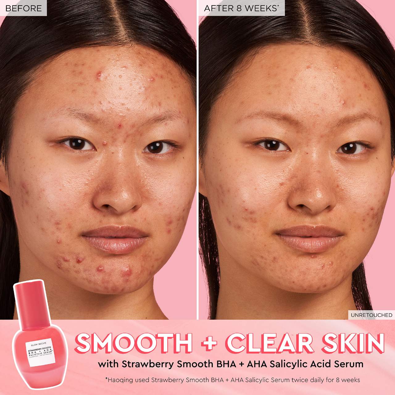 Suero de ácido salicílico BHA + AHA Strawberry Smooth