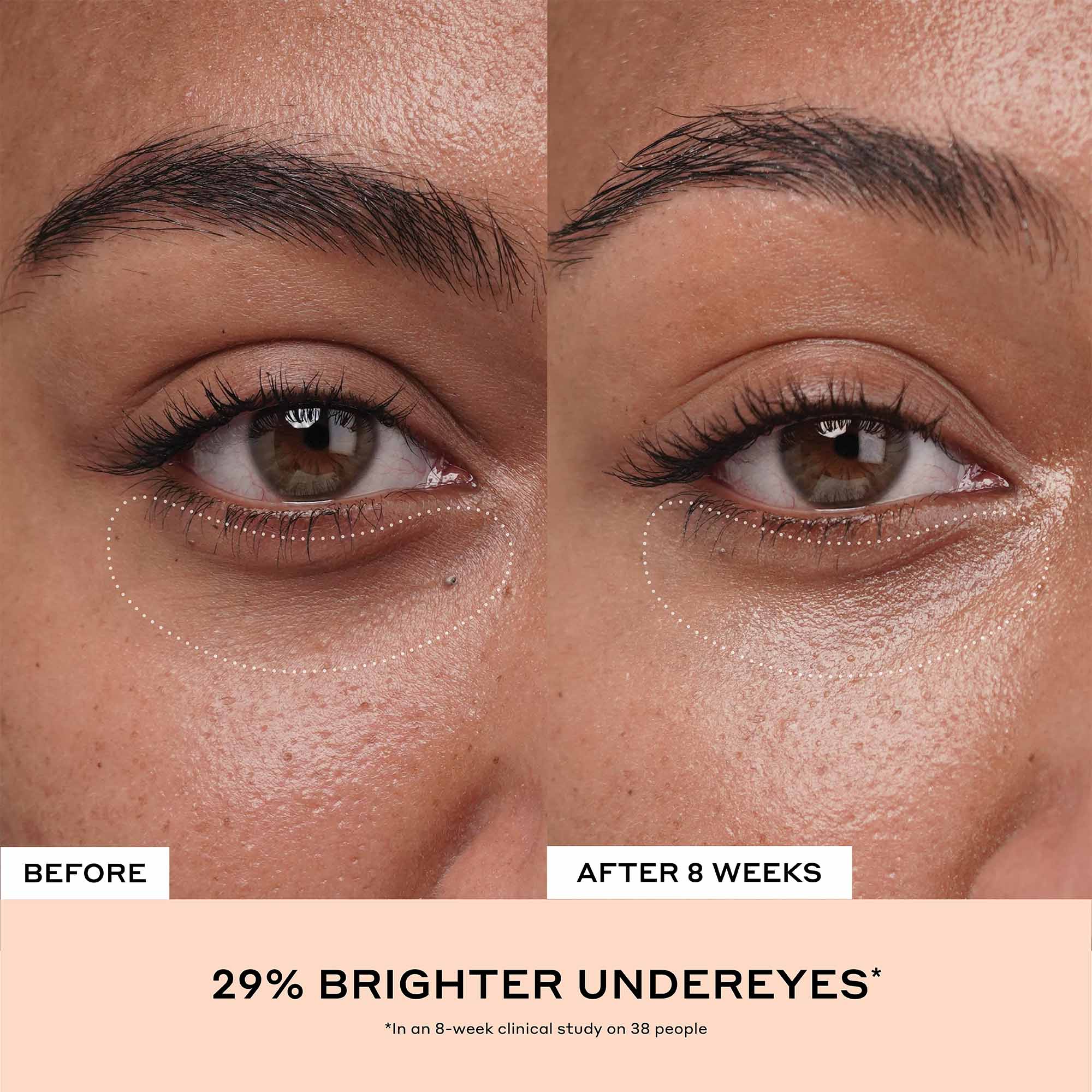 Crema para ojos con vitamina C Banana Bright+ para ojeras