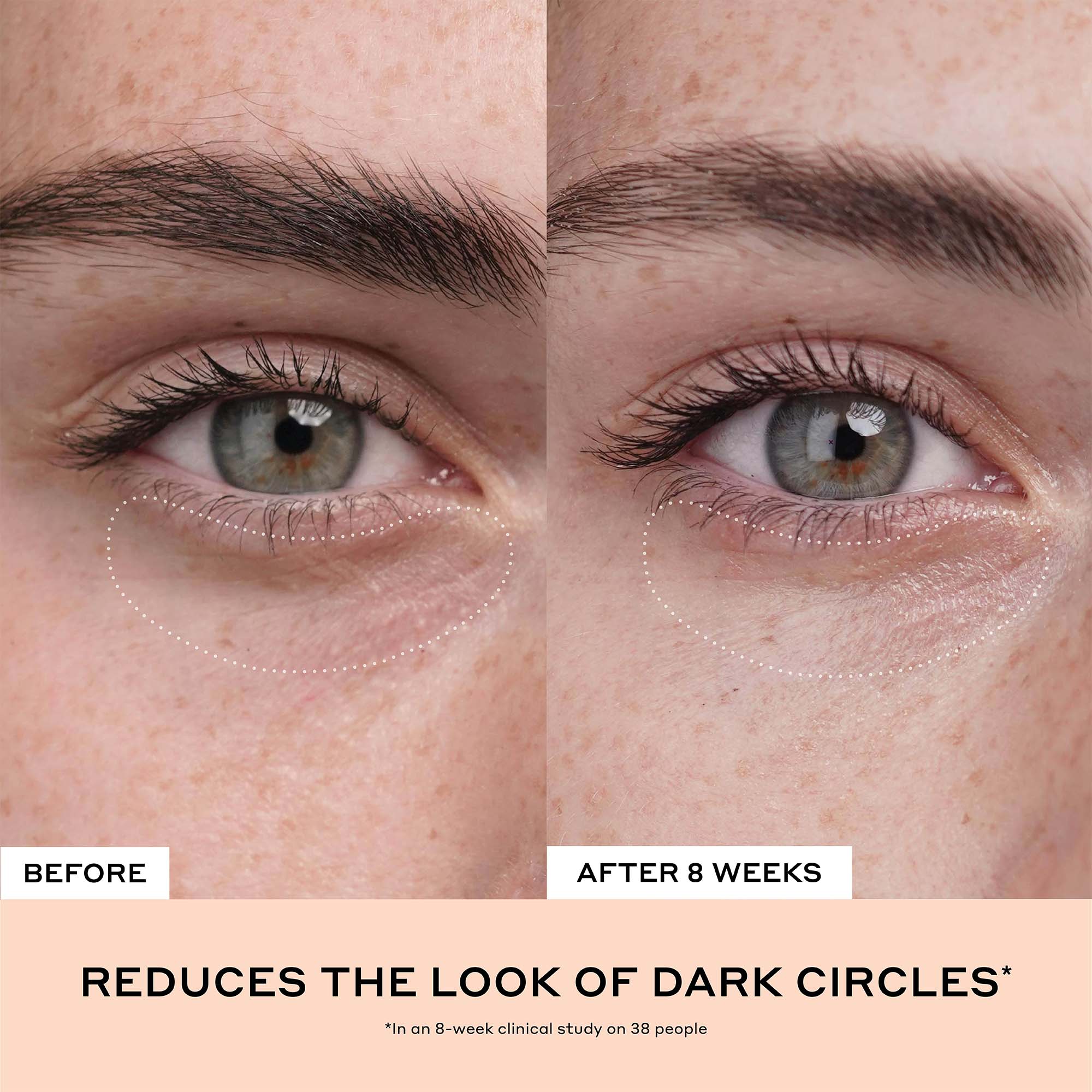 Crema para ojos con vitamina C Banana Bright+ para ojeras