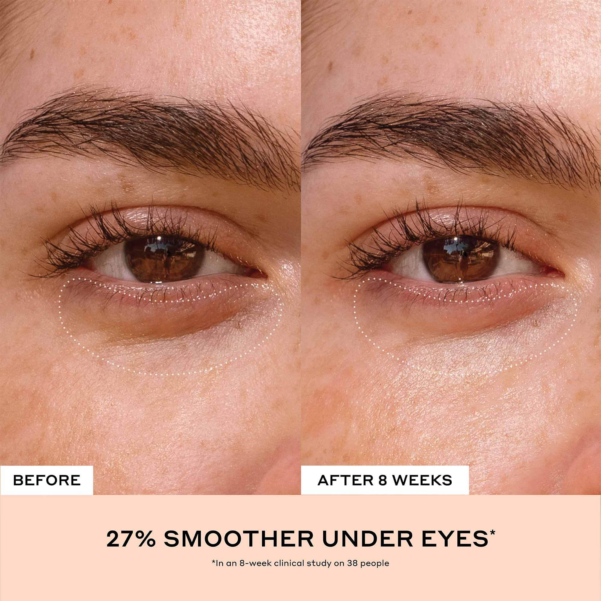 Crema para ojos con vitamina C Banana Bright+ para ojeras