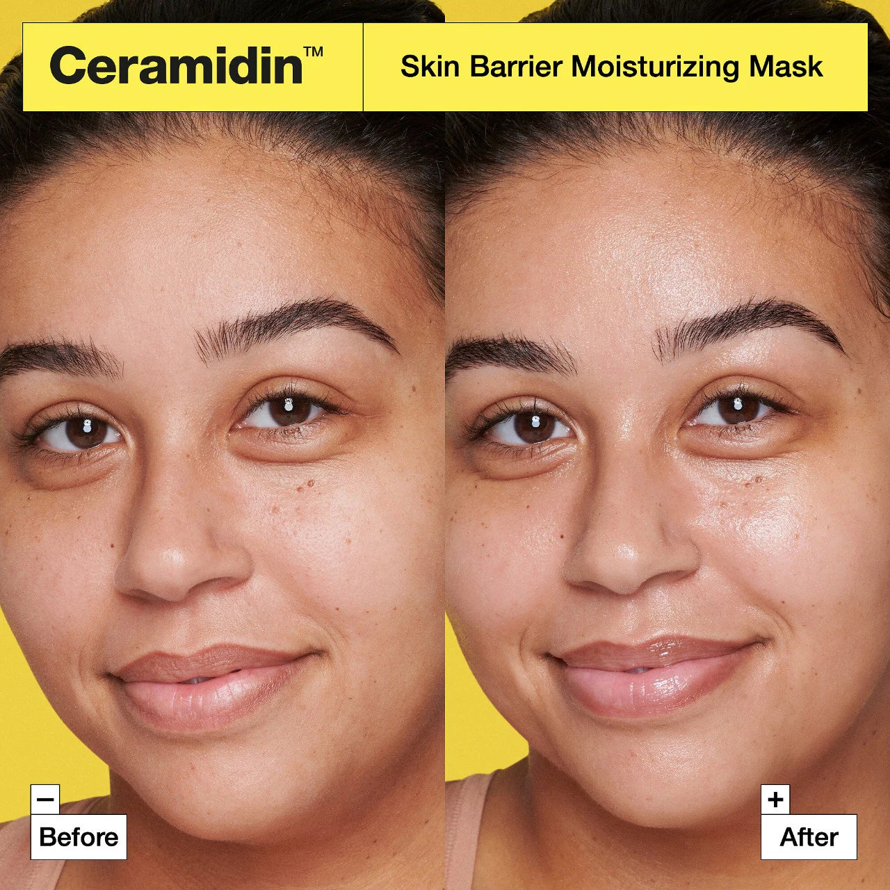 Mascarilla hidratante de barrera cutánea Ceramidin™
