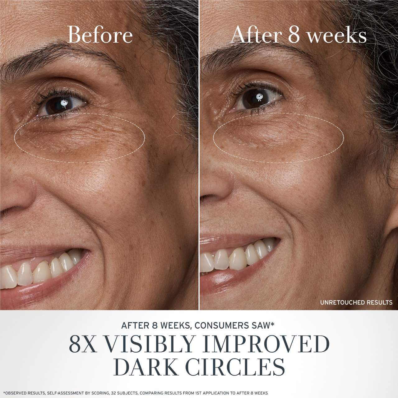 Crema antiedad para ojos de té negro con retinol alternativo BT Matrix