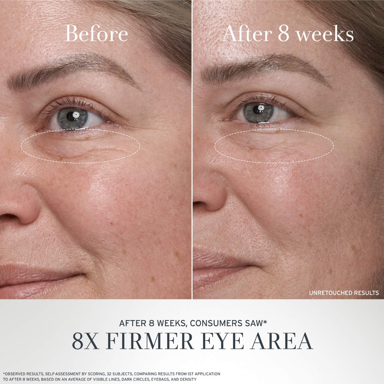 Crema antiedad para ojos de té negro con retinol alternativo BT Matrix