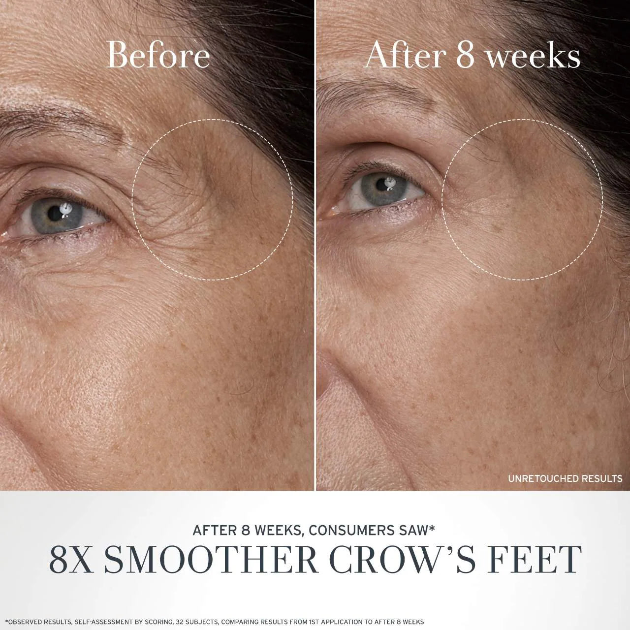 Crema antiedad para ojos de té negro con retinol alternativo BT Matrix