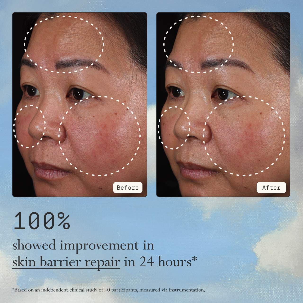 Hidratante instantáneo Angel rico en lípidos y péptidos + Reparación de la barrera cutánea