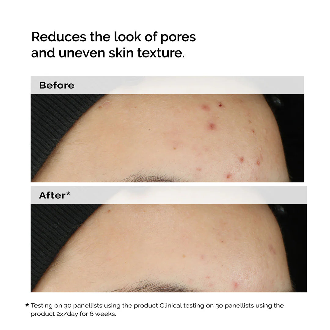 Suero equilibrante y aclarante para pieles con tendencia a imperfecciones
