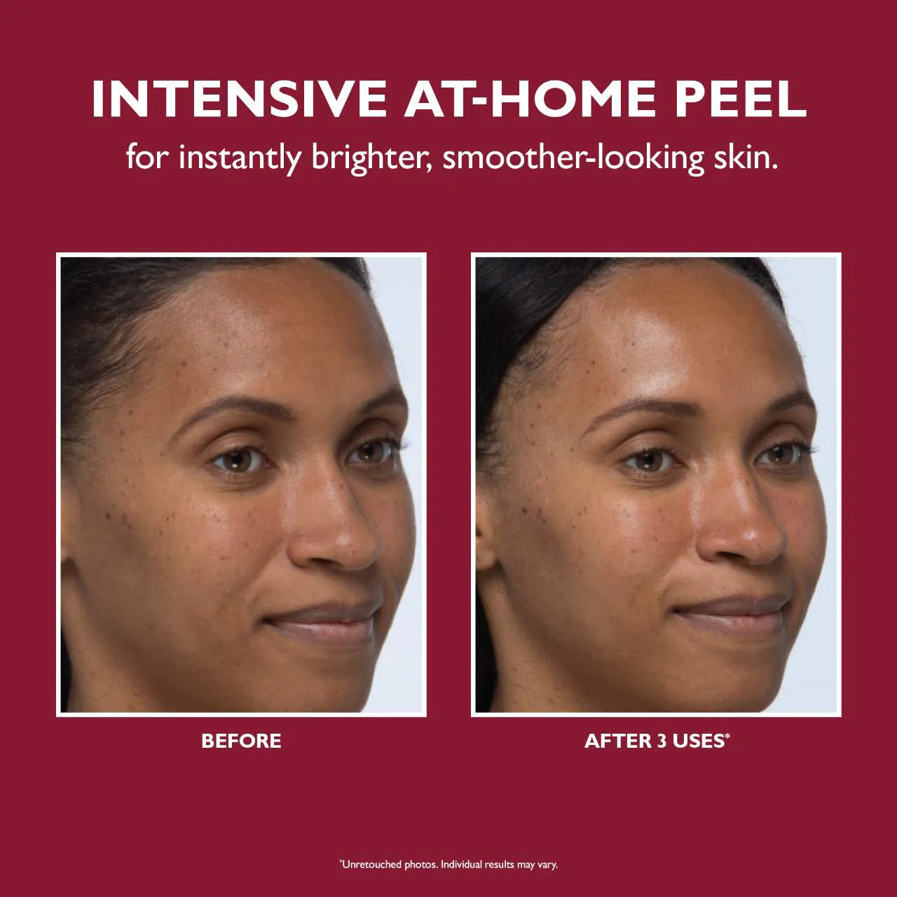 Peeling facial instantáneo Even Smoother™