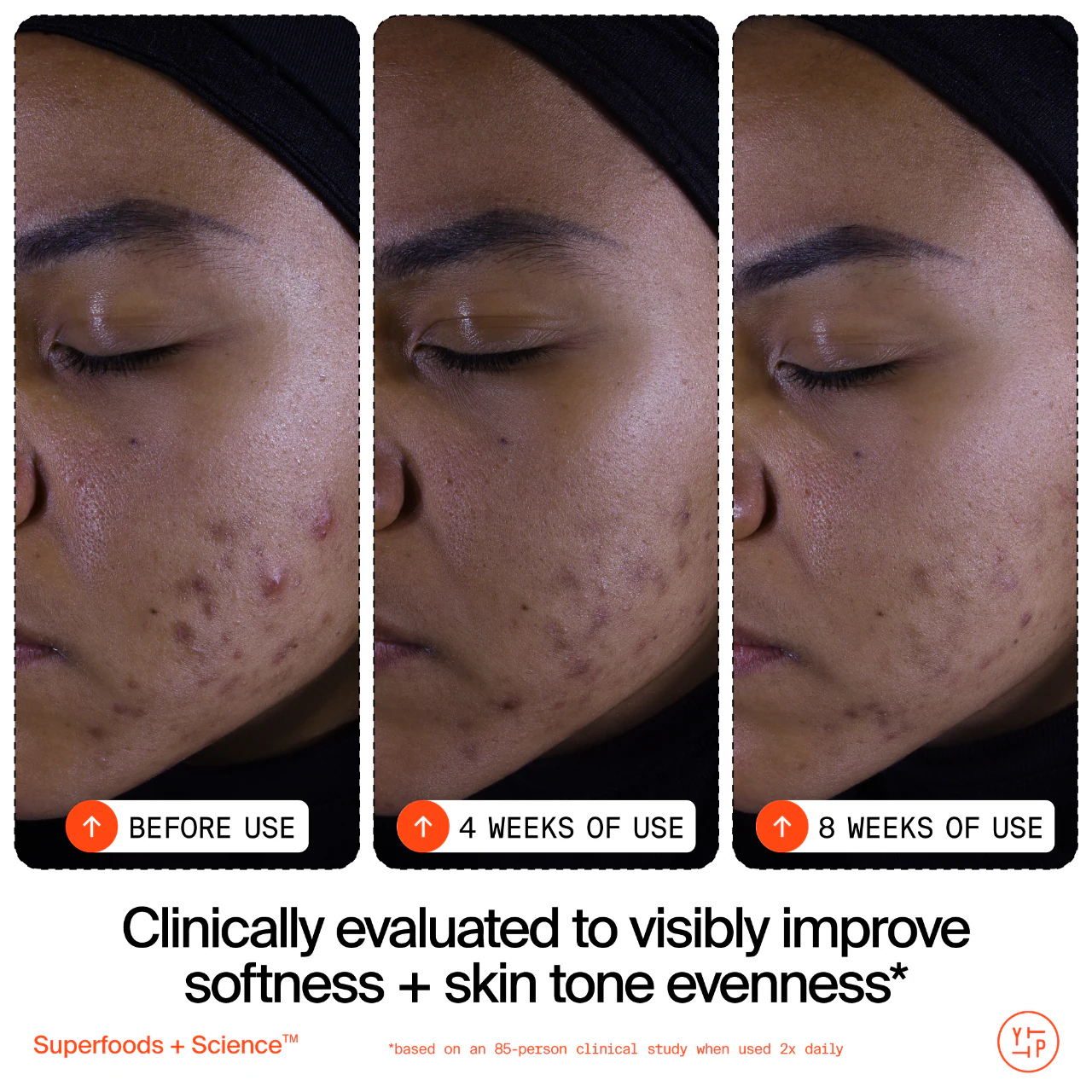 Limpiador exfoliante suave Superfruit con vitamina C y papaya
