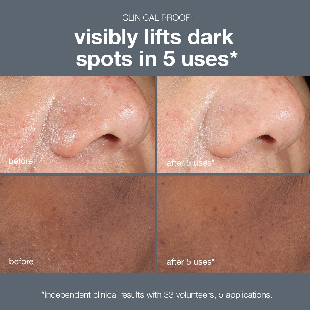 Peeling para manchas oscuras PowerBright