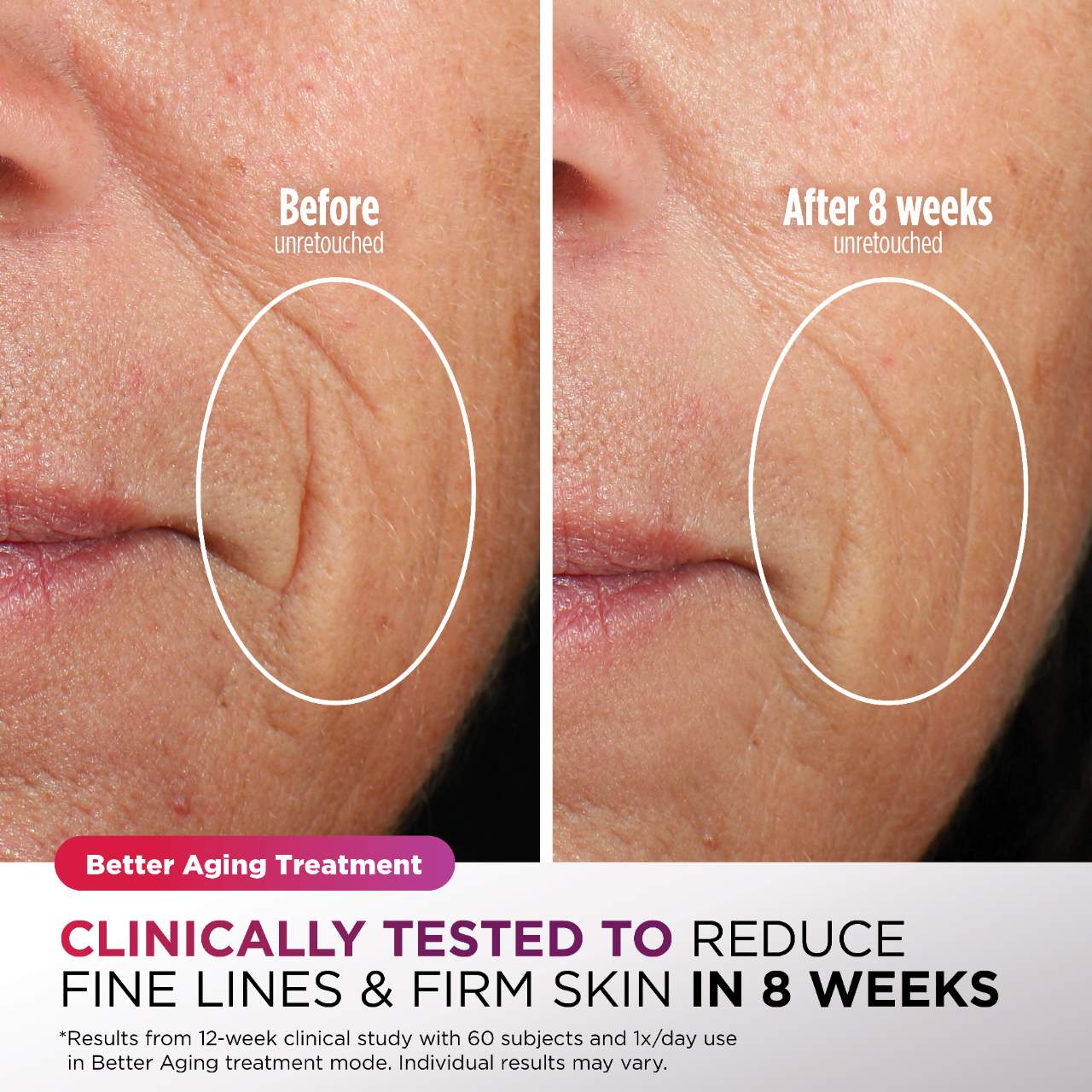 Máscara facial refrescante y LED CryoGlow™